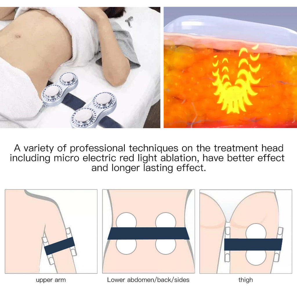 SQ47B Pro 6-i-1 40K kavitationsapparat med laser, EMS, RF og vakuum