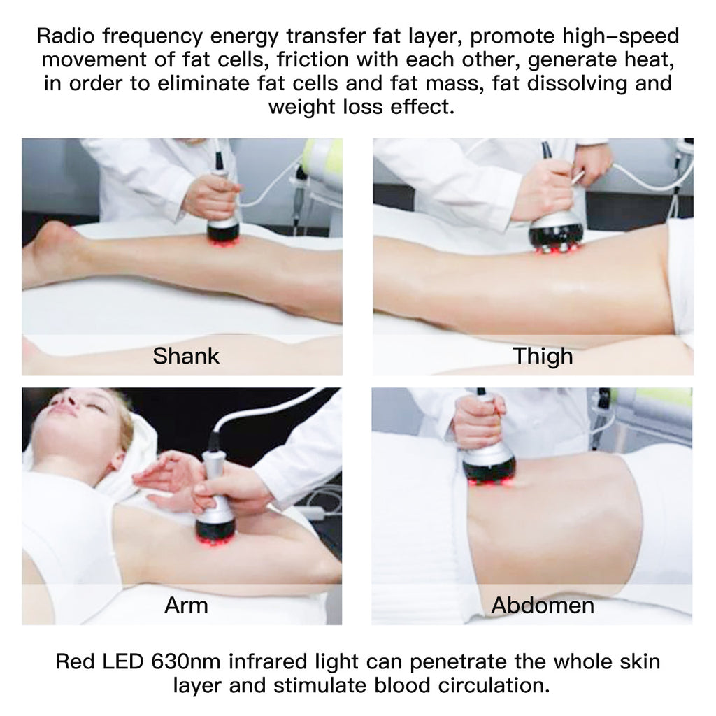 SQ47B Pro 6-i-1 40K kavitationsapparat med laser, EMS, RF og vakuum