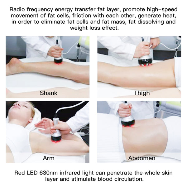 SQ47B Pro 6-i-1 40K kavitationsapparat med laser, EMS, RF og vakuum
